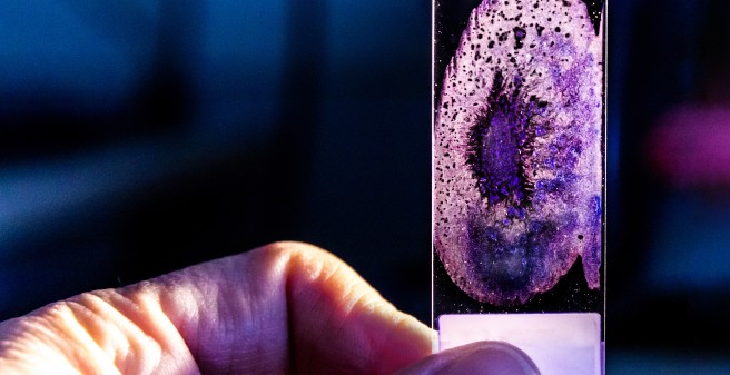 Section of bone in von Kossa staining