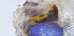 Intraoperative 3D printing