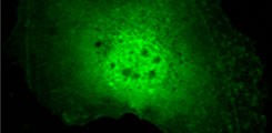 Photo Diagnostic Group GFP-YopEΔMLD